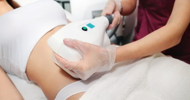 Benefits Of Non-Surgical Body Sculpting