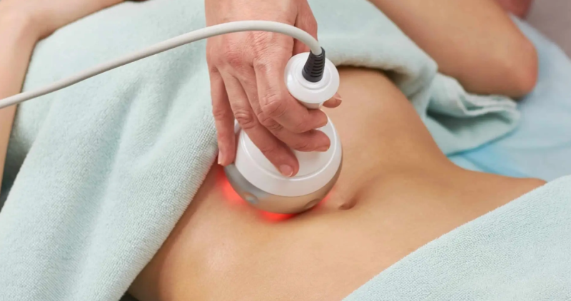 Skin Tightening