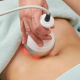 Skin Tightening