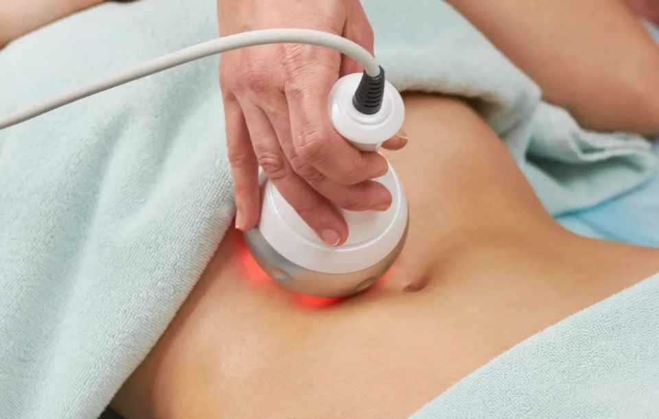 Skin Tightening